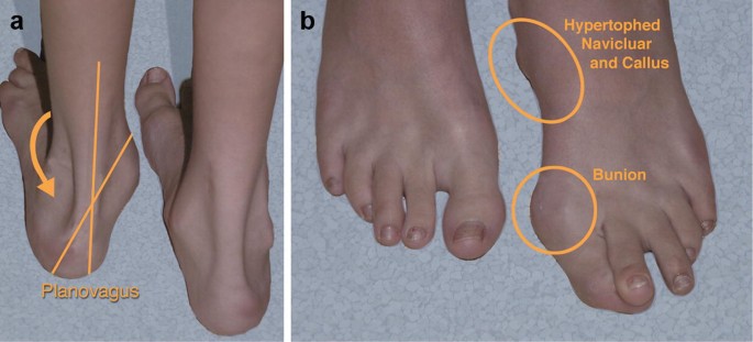 patricia sartorius feet 3