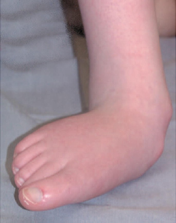 patricia sartorius feet 4