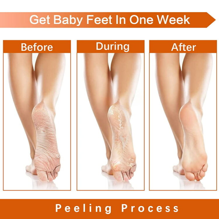 peaches feet 3