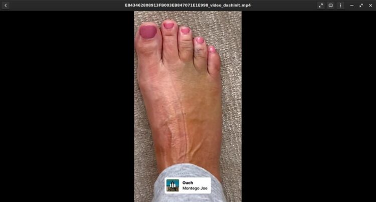 pernille rosendahl feet 3