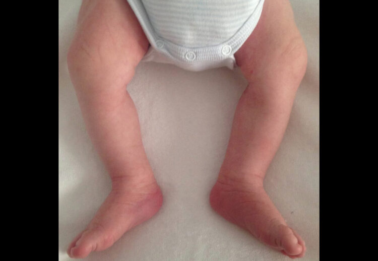 petit bout de soleil feet 6