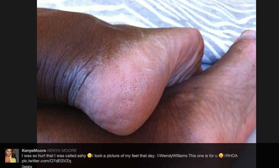 phaedra parks feet 3