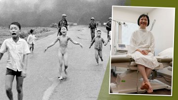 phan thi kim phuc feet 1