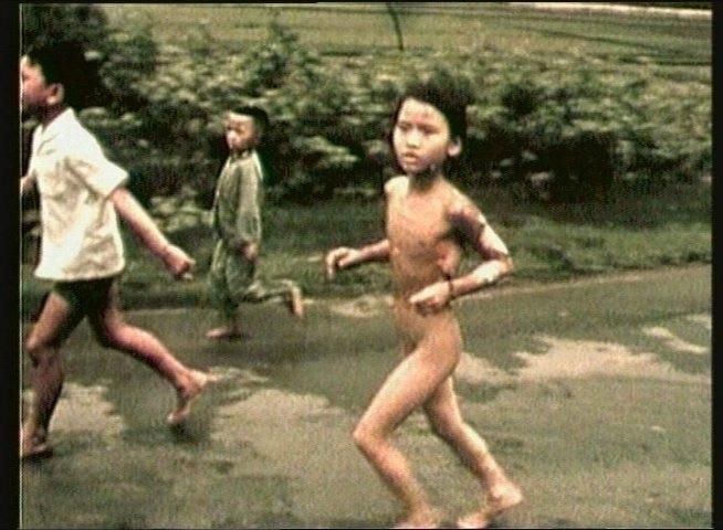 phan thi kim phuc feet 3