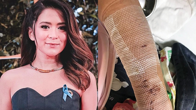 positive chika antonette feet 1