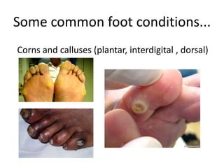 qu knhiya hill feet 2