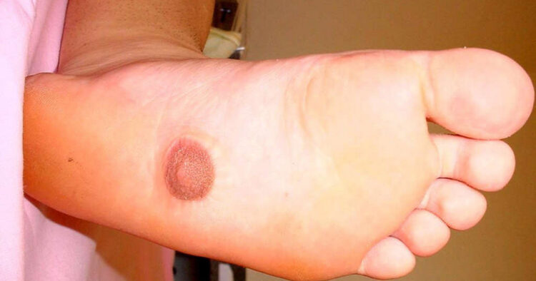 rachael sutek feet 4