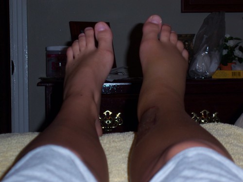 rachel hernandez feet 1