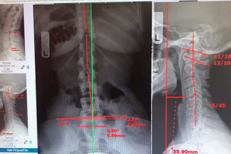 renae largent feet 1