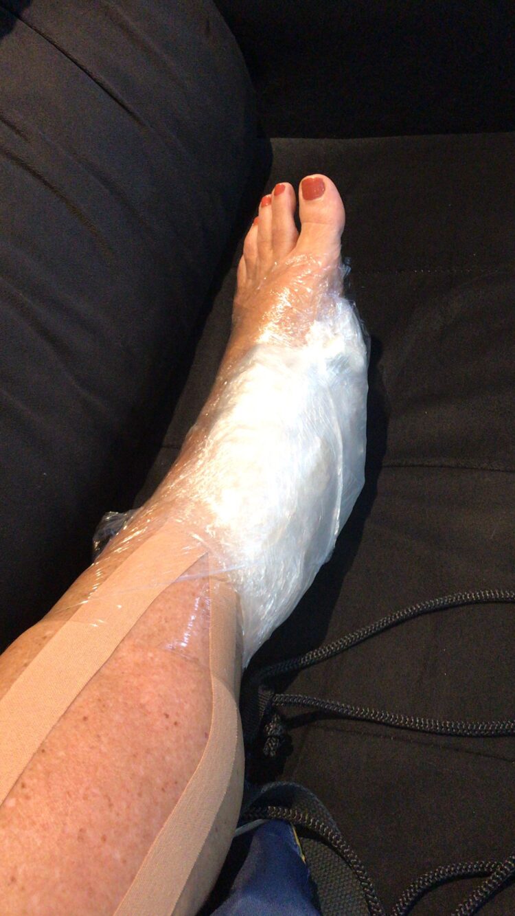 rosana hermann feet 1