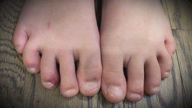 rosemary barton feet 1