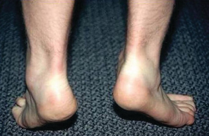 s.j. mendelson feet 5