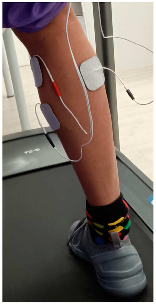 s.j. mendelson feet 6