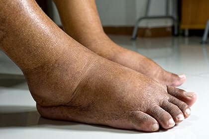 sabina florea feet 5