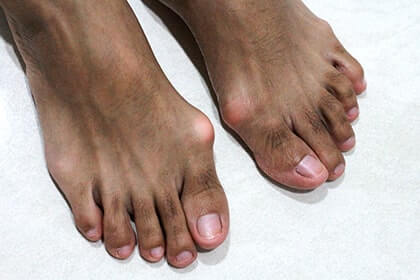 sabina florea feet 6