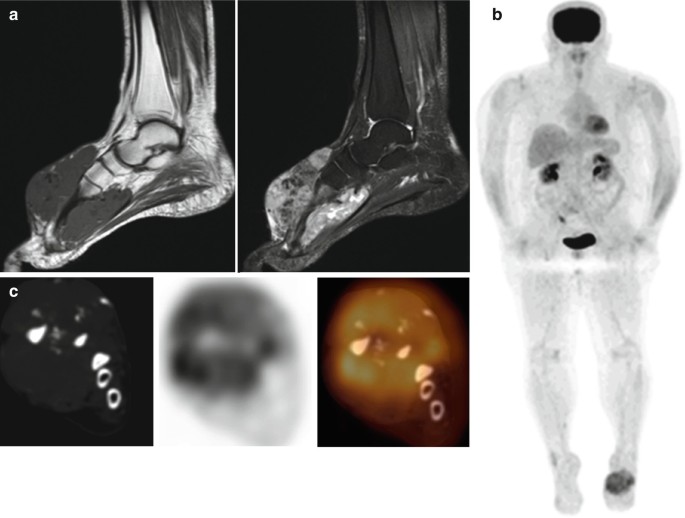 sabri regueira feet 1