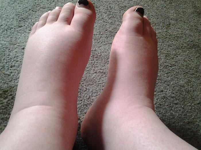 saltymermaident feet 6