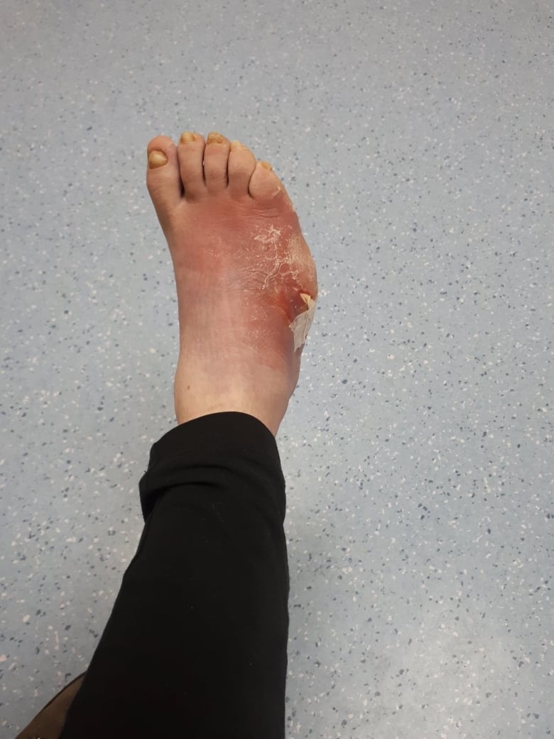 samantha strange feet 1