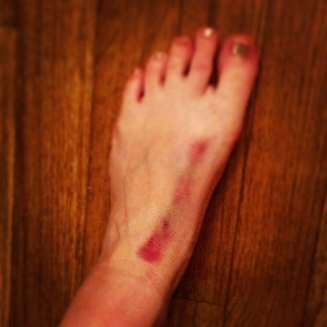 sarah whittle feet 4