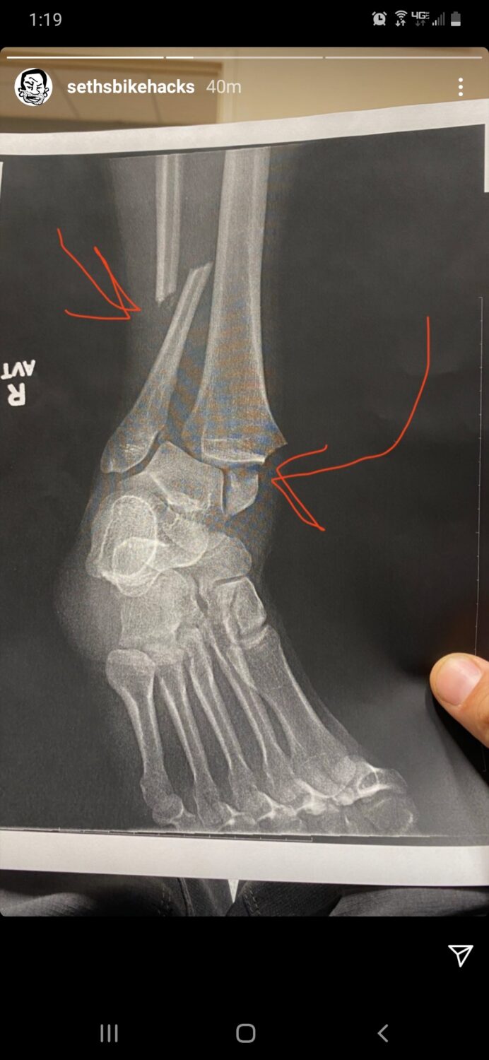 seths bike hacks feet 1