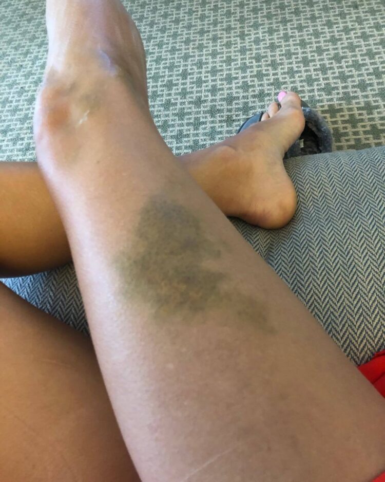 shannon murphy feet 4