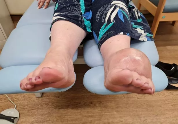 sharon d. clarke feet 5