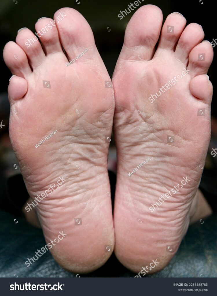 shday a. feet 1