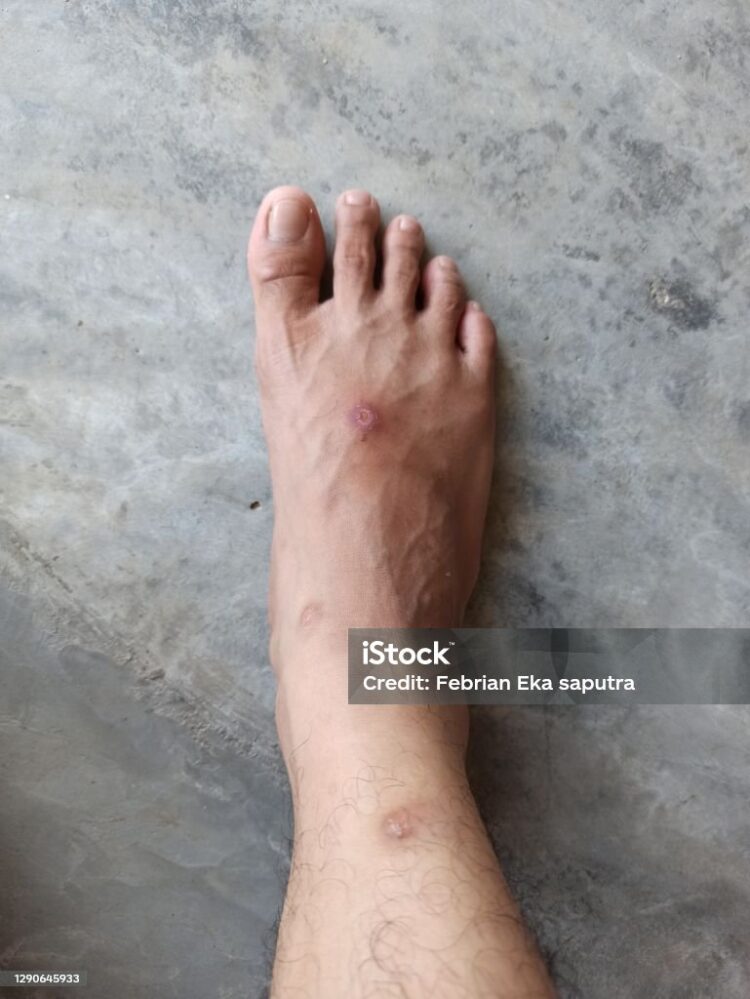 shizue cortes feet 1