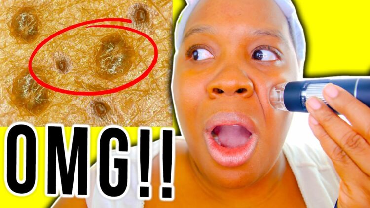 shundara castion feet 5