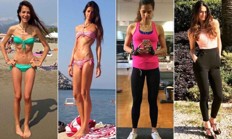 silvia fascians feet 6