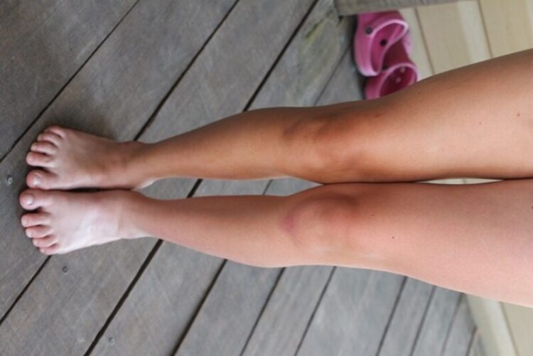 simplynabiki feet rotated