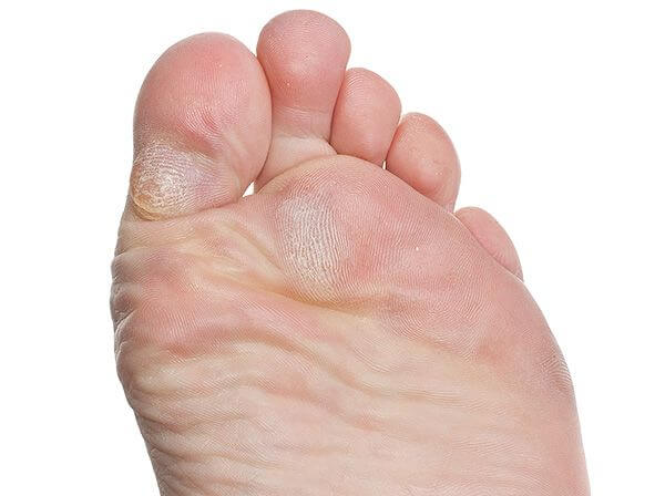 skin feet 4