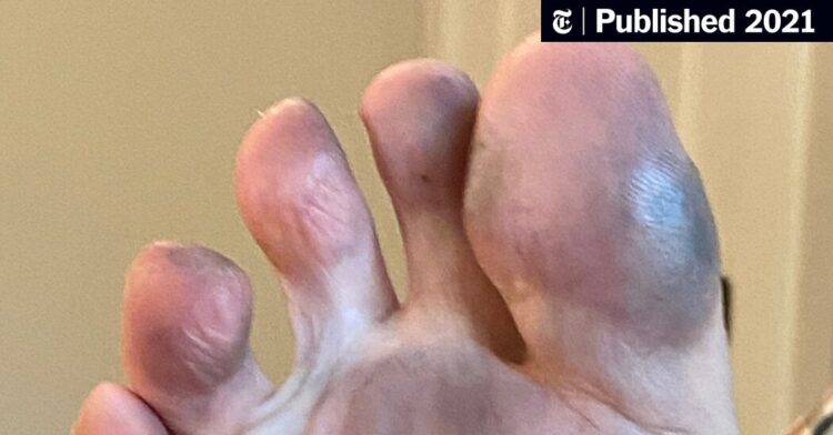 audra hofmeister feet 6