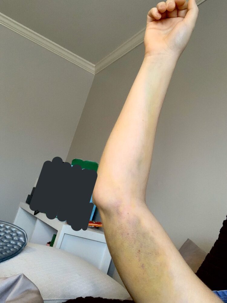 sophia armata feet 1