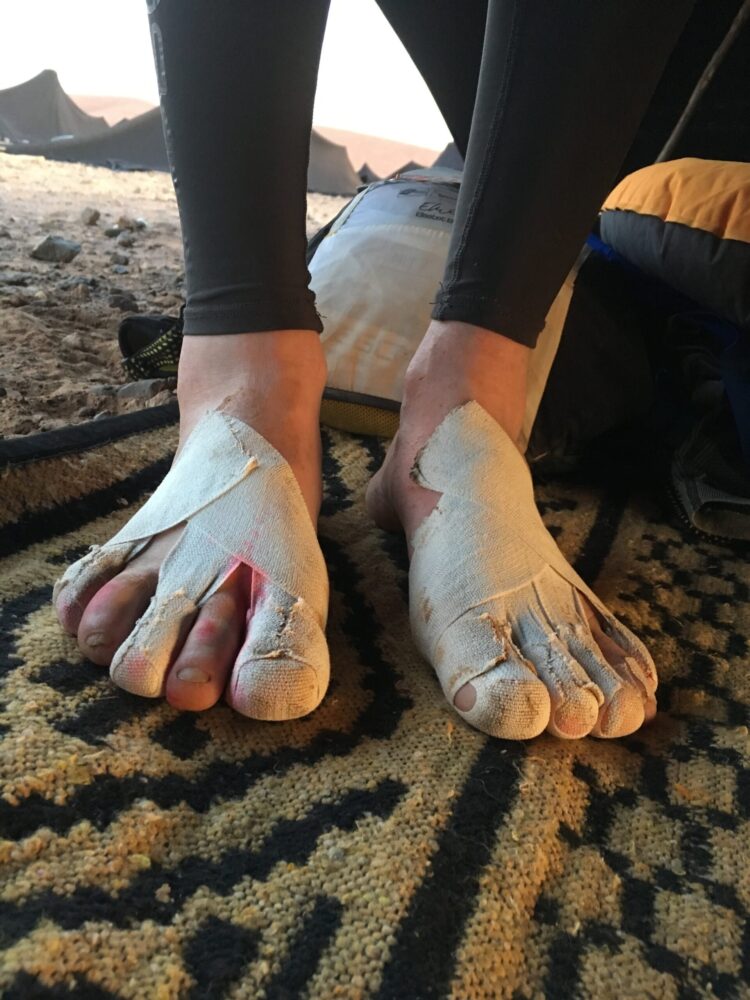 sophie chan feet 6 scaled