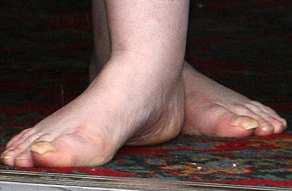 susan boyle feet