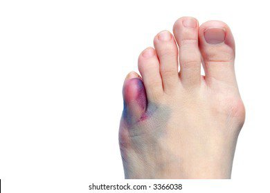 sutton eisenman feet 1