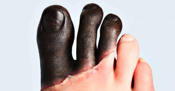 sutton eisenman feet 6