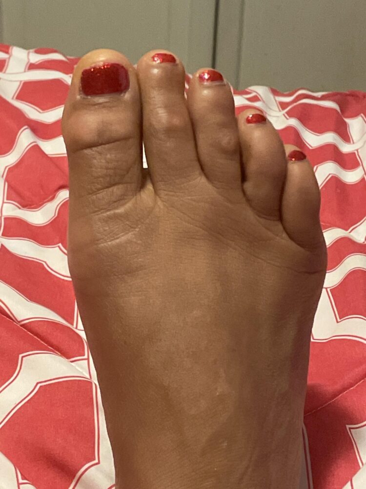 sydney wolfrum feet scaled