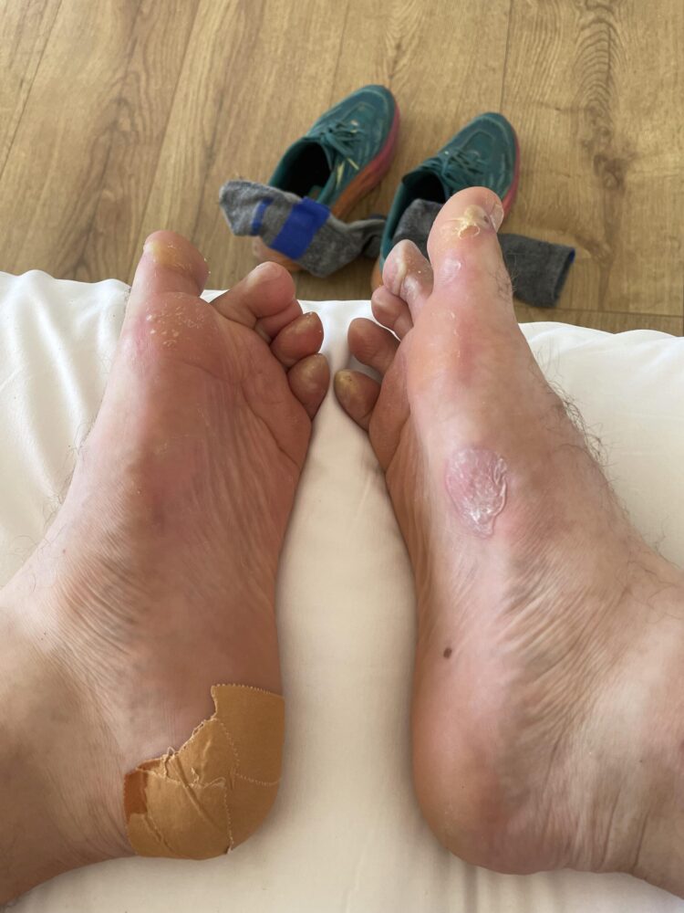 taylor burgos feet scaled