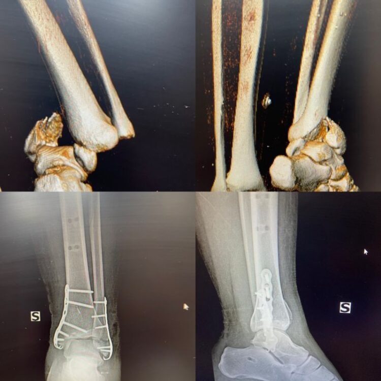 taylor caldwell feet 4