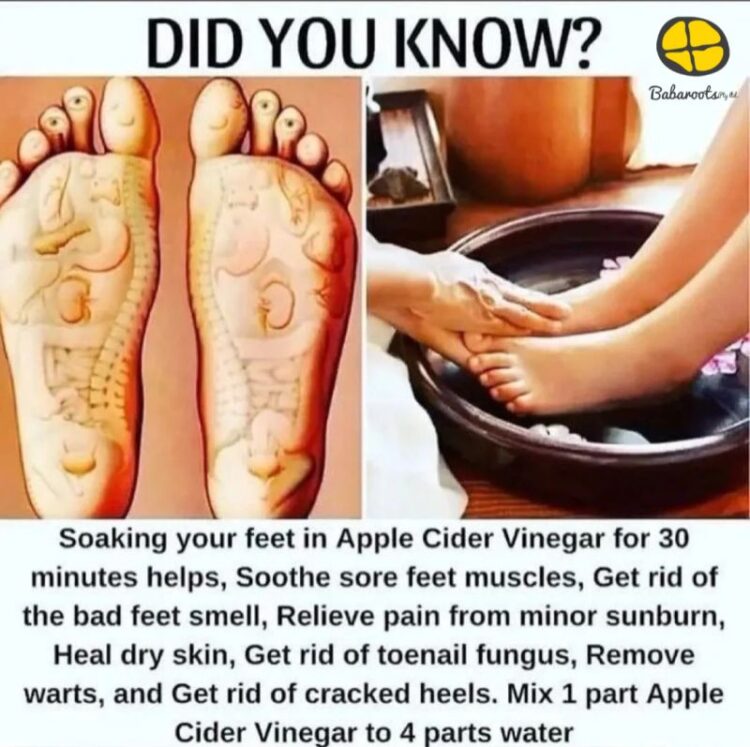 teresa cormack feet 6