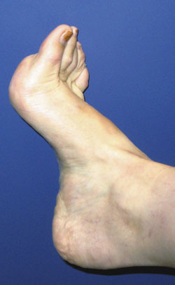 terry cavanagh feet 1