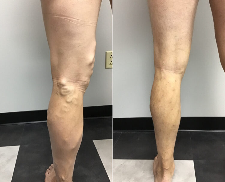 thamires ximenes feet 5