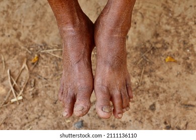 the android miner feet 1