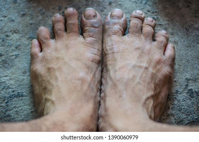 the android miner feet 3