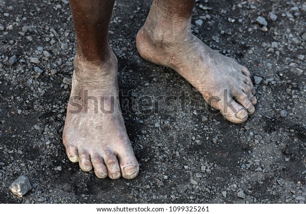 the android miner feet