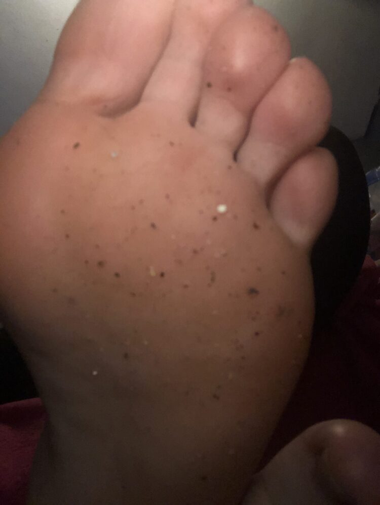 theskym feet 2 scaled