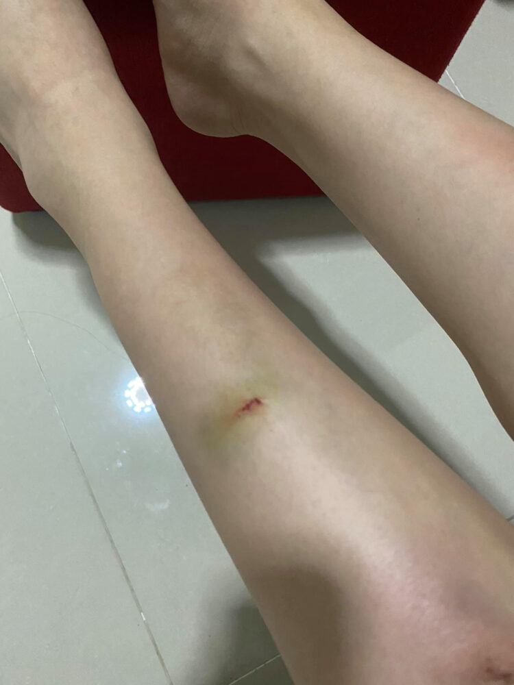 thieu bao tram feet 3