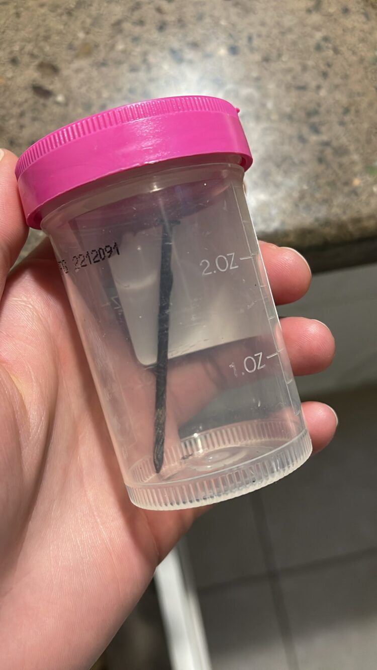 tiernan hickson feet 3